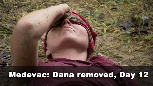 Dana removed, Day 12